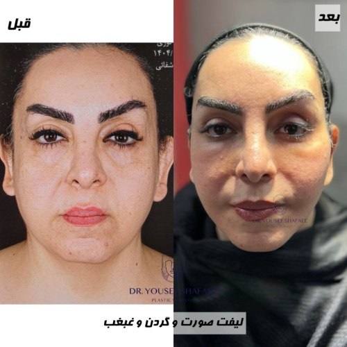 دکتر یوسف شفائی