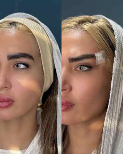 بهترین کلینیک زیبایی در شهرک گلستان منطقه 22 تهران