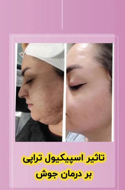 بهترین سالن زیبایی در اشرفی اصفهانی منطقه 5