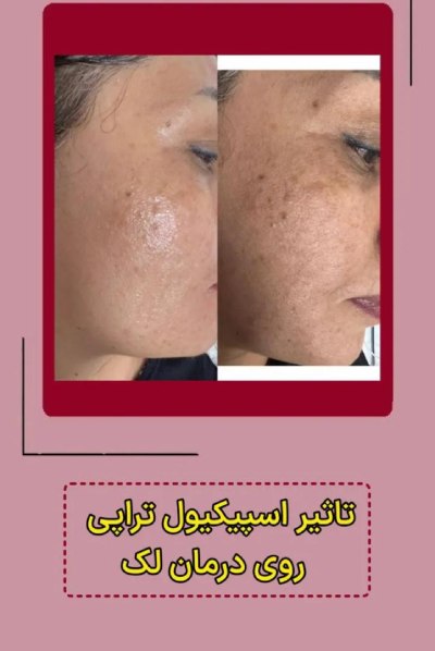 بهترین سالن زیبایی در اشرفی اصفهانی منطقه 5