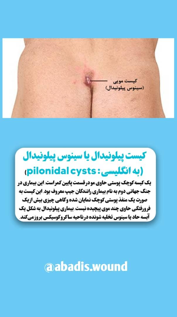 بهترین درمانگر زخم در نارمک