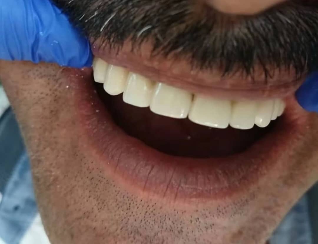 دکتر زانیار سلطانی دکترای حرفه ای دندانپزشکی