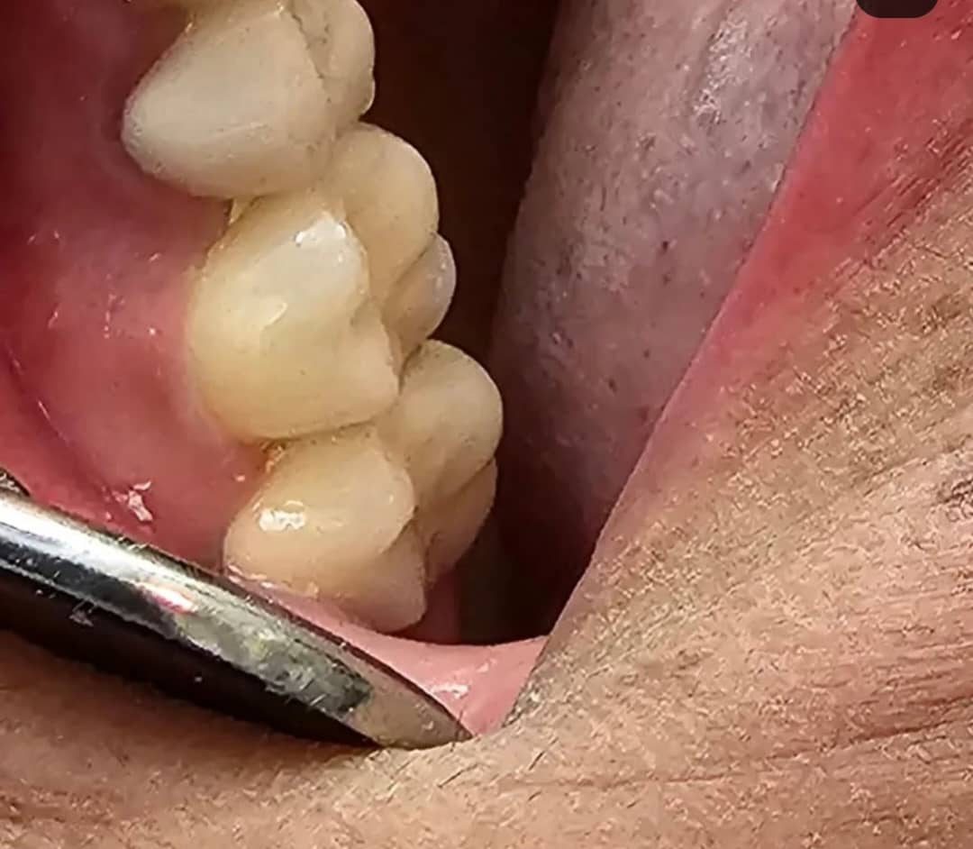 دکتر زانیار سلطانی دکترای حرفه ای دندانپزشکی