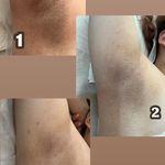 بهترین کلینیک لیزر موهای زائد در نیرو هوایی