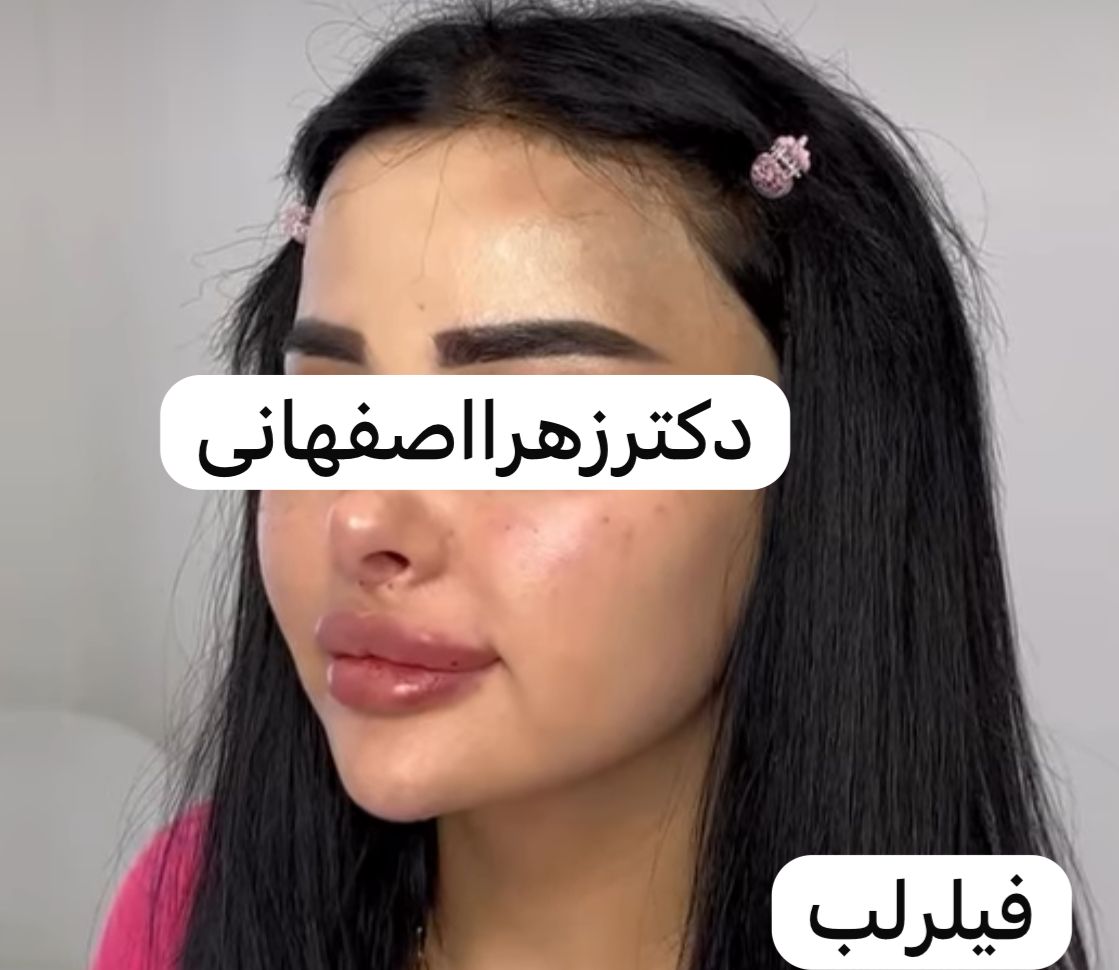 بهترین کلینیک زیبایی در مشیریه