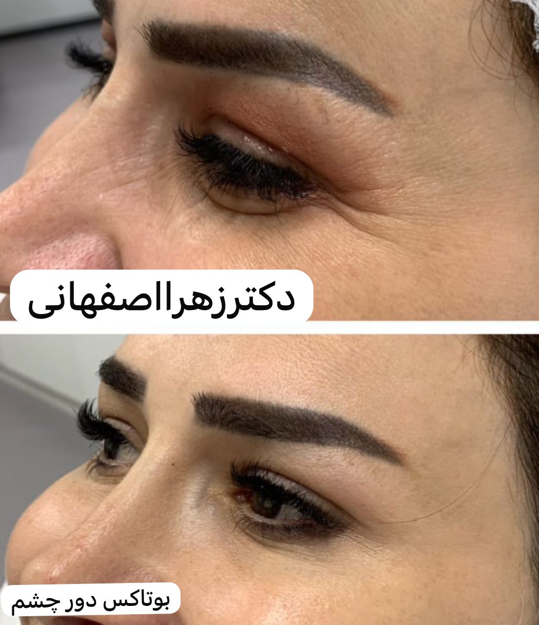 بهترین کلینیک زیبایی در مشیریه