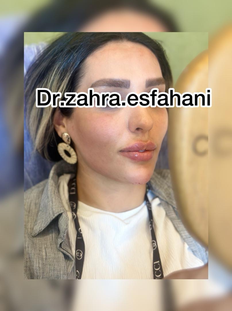 بهترین کلینیک زیبایی در مشیریه