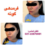 بهترین کلینیک لاغری در شمال تهران
