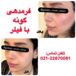 بهترین کلینیک لاغری در شمال تهران