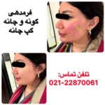 بهترین کلینیک لاغری در شمال تهران