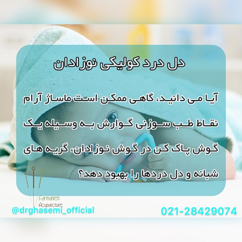 بهترین کلینیک طب سوزنی در پیروزی