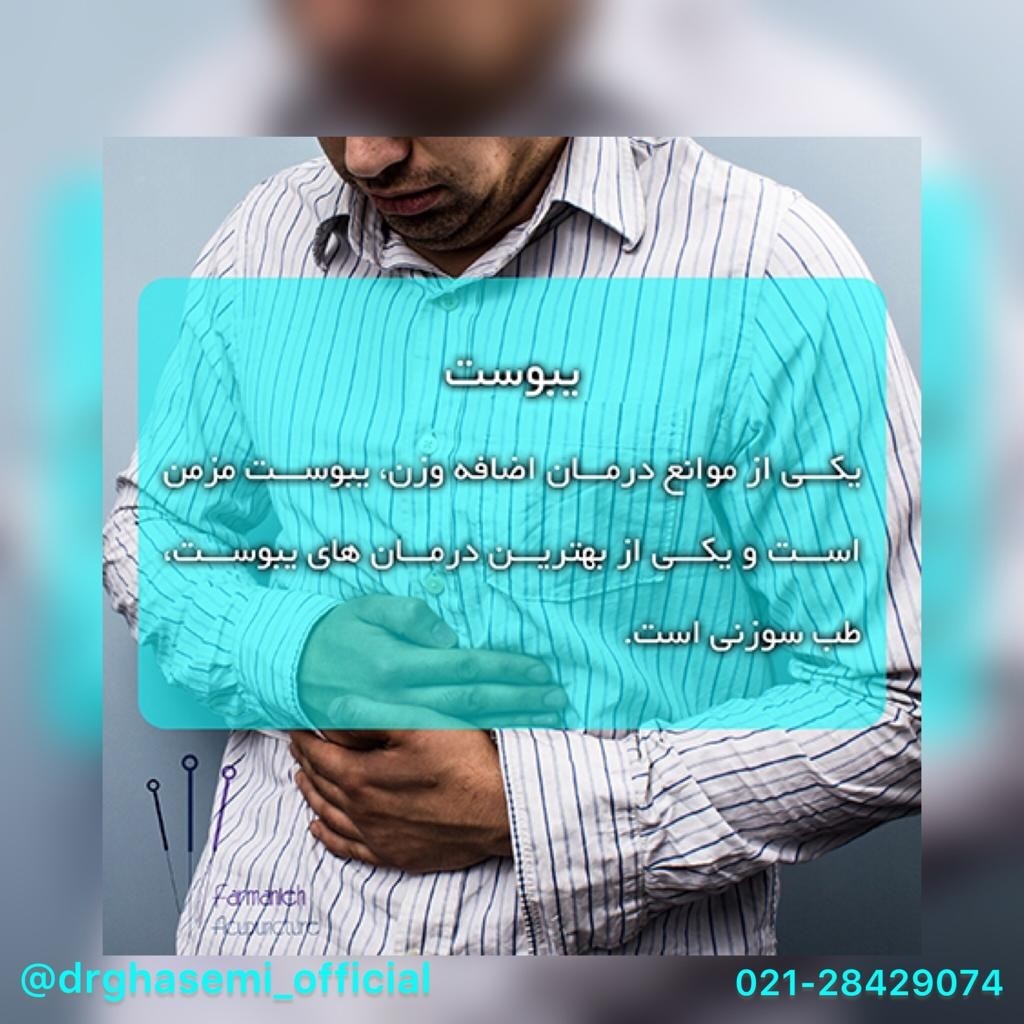 بهترین کلینیک طب سوزنی در پیروزی