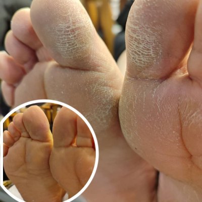 مرکز تخصصی کاشت ناخن در دولت