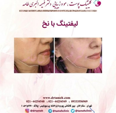 کلینیک تخصصی پوست و مو در ستارخان تهران