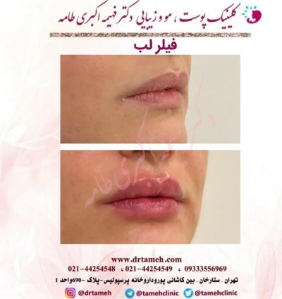 کلینیک تخصصی پوست و مو در ستارخان تهران