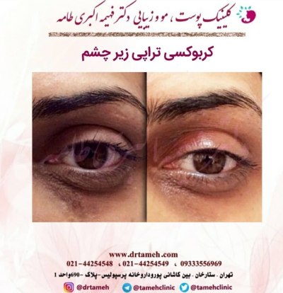 کلینیک تخصصی پوست و مو در ستارخان تهران