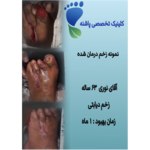 بهترین کلینیک زخم در هروی