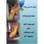 بهترین  کلینیک زخم در شریعتی
