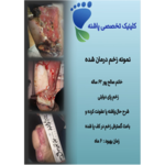 بهترین  کلینیک زخم در شریعتی