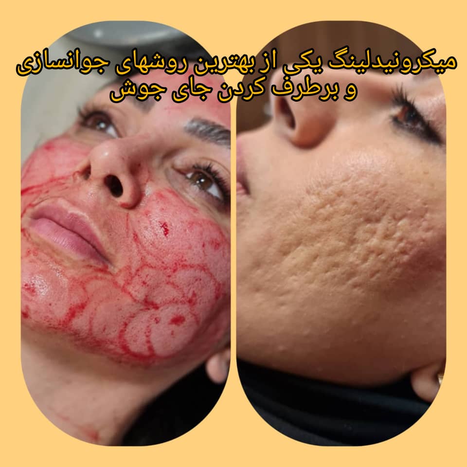 بهترین تزریق فیلر و بوتاکس در خواجه عبدالله انصاری تهران