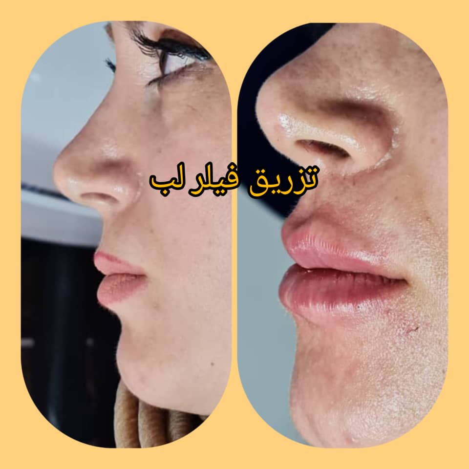 بهترین تزریق فیلر و بوتاکس در خواجه عبدالله انصاری تهران