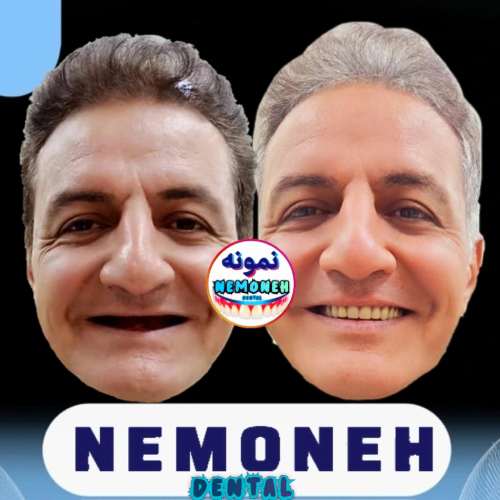 بهترین دندانسازی در گیشا منطقه تهران