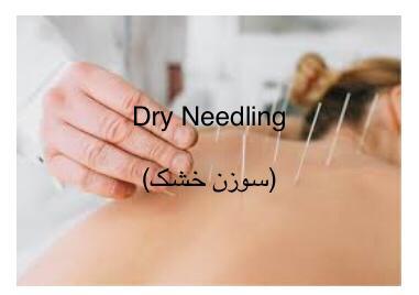 متخصص فیزیوتراپی خوب در محدوده غرب تهران