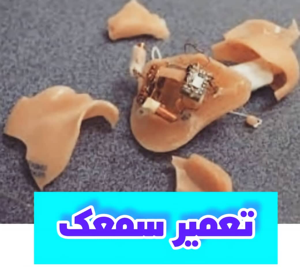 نمایندگی فروش سمعک در مرزداران