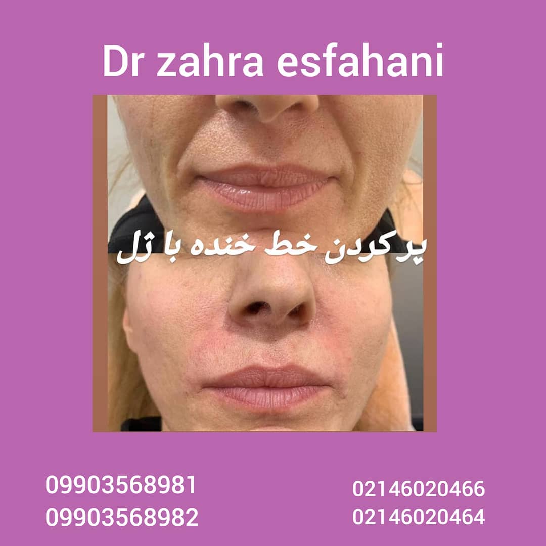 بهترین کلینیک تزریق ژل و بوتاکس در مشیریه