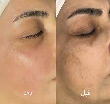کلینیک زیبایی پوست و مو در پونک تهران