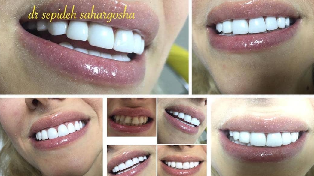 بهترین کلینیک دندانپزشکی در باغ فیض