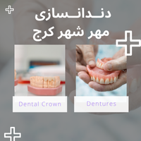 لابراتور دندانسازی در مهر شهر کرج