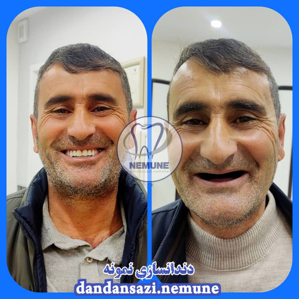 بهترین دندانسازی در ستارخان