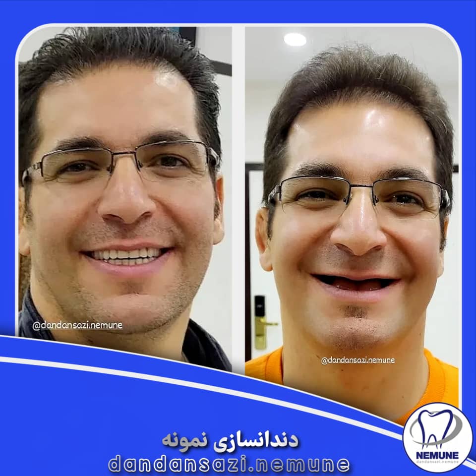 بهترین کلینیک دندانسازی در غرب تهران