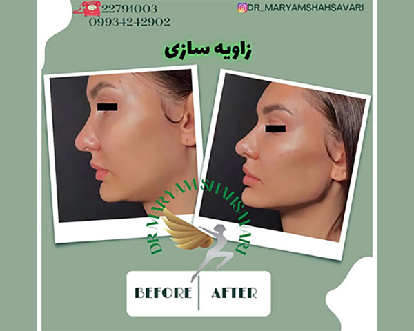بهترین کلینیک زیبایی در تهران دکتر مریم شهسواری