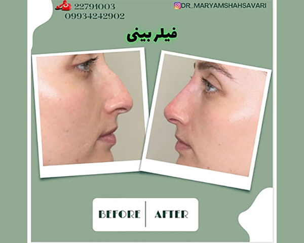 بهترین کلینیک زیبایی در شمال تهران | خدمات تخصصی با دکتر مریم شهسواری