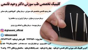 بهترین کلینیک طب سوزنی در شمال تهران