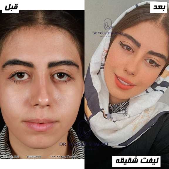 دکتر یوسف شفائی