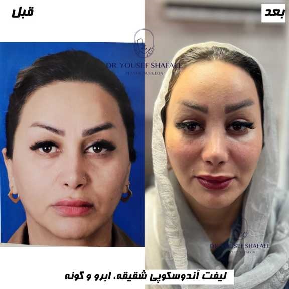 دکتر یوسف شفائی