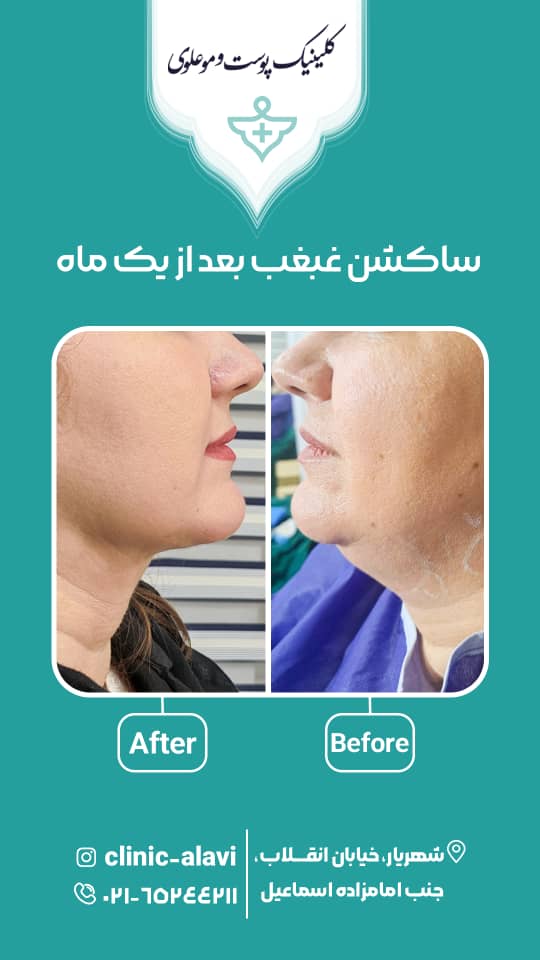 کلینیک زیبایی علوی