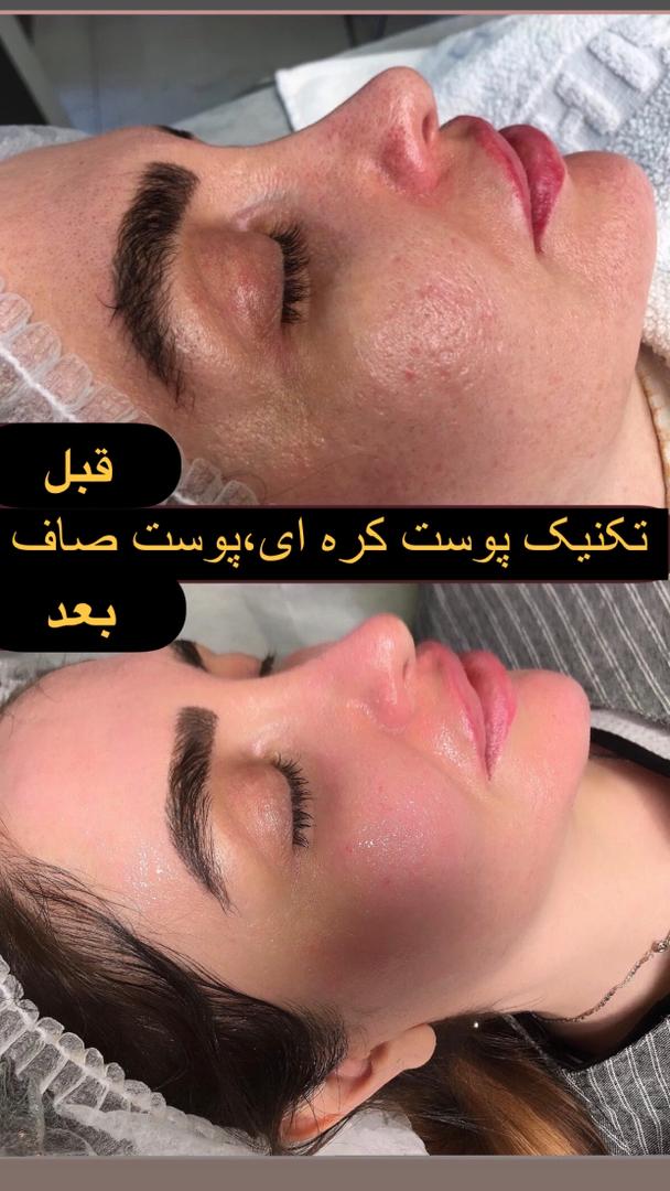 مجموعه زیبایی ایران بیوتی و فلوریا میرزایی