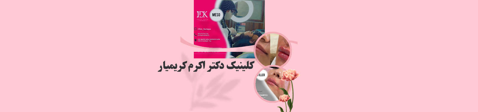 بهترین مرکز تزریق ژل و بوتاکس در نازی آباد کلینیک زیبایی