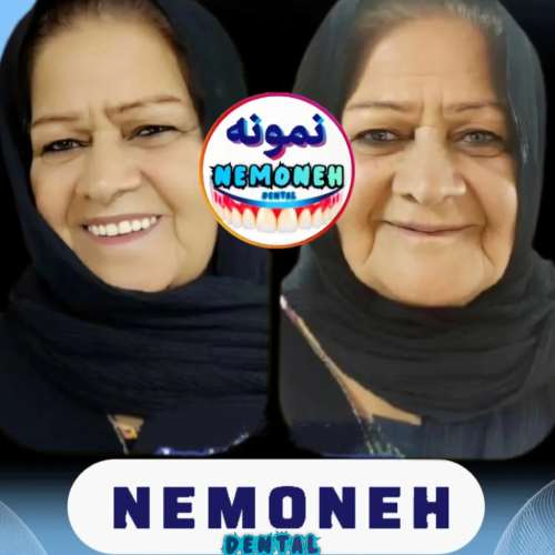 دندانسازی تهران