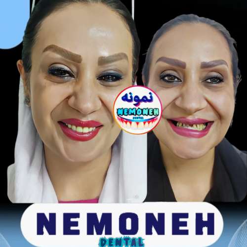 دندانسازی اصفهان